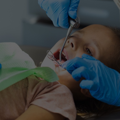 Pediatric Crowns Banner Picture